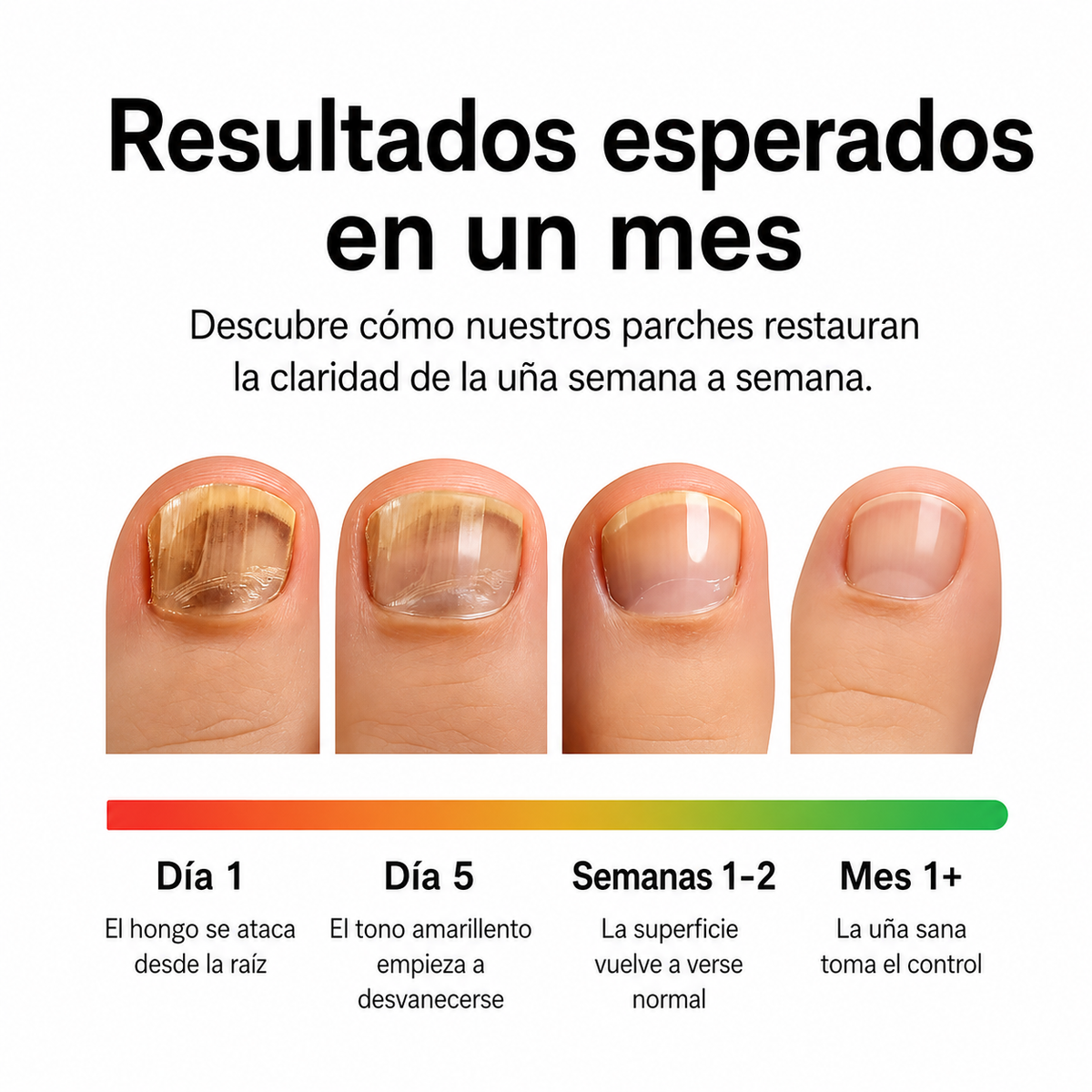 Belvry NailRenew™